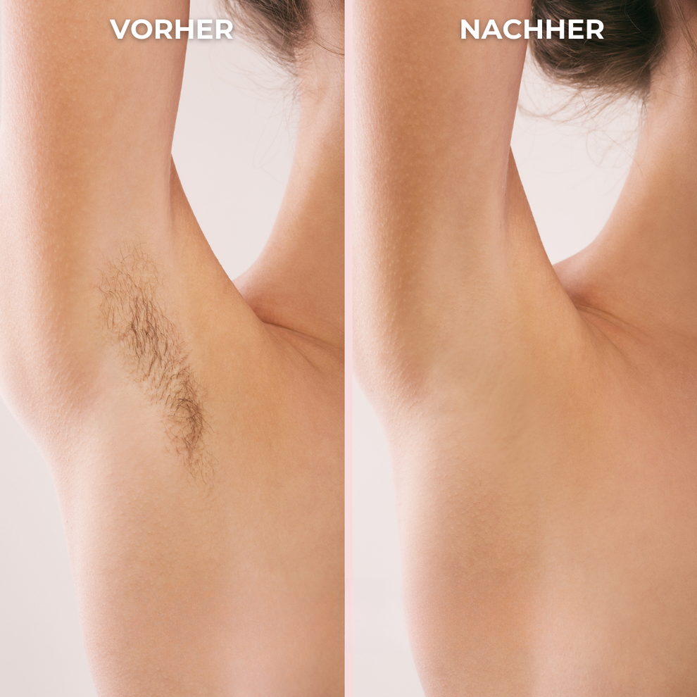 Bikini-Trimmer für Frauen